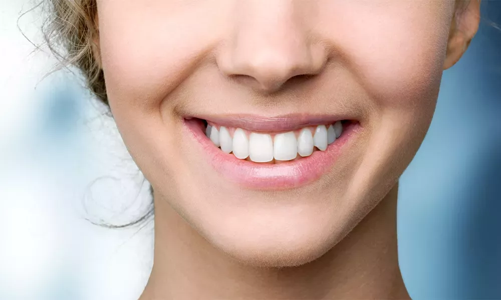 Who Makes a Good Candidate for Teeth Whitening?
