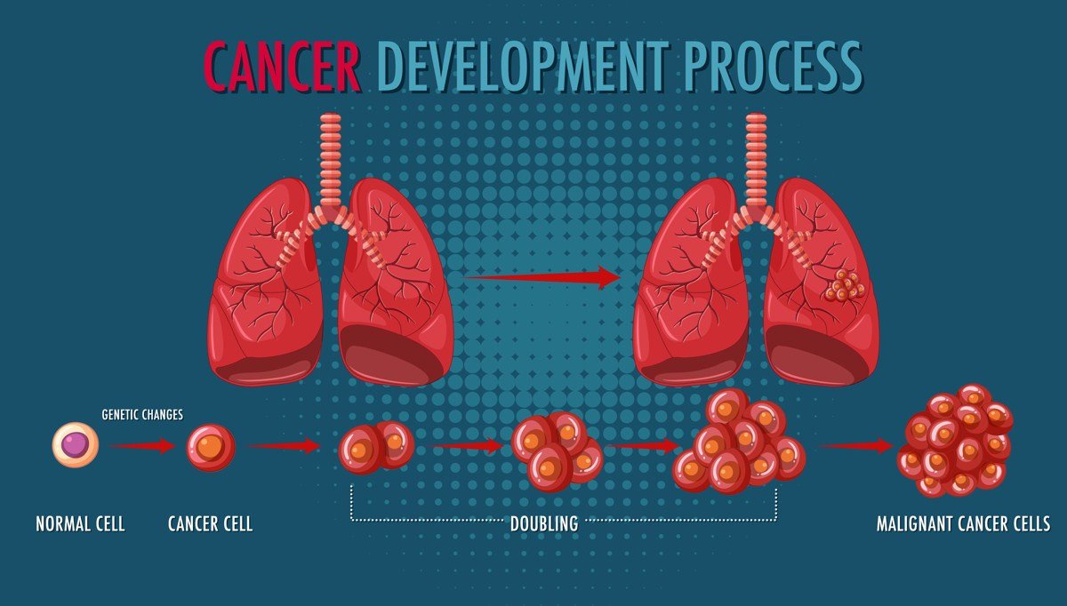 Smoking and Cancer Risks and Effects in 2023