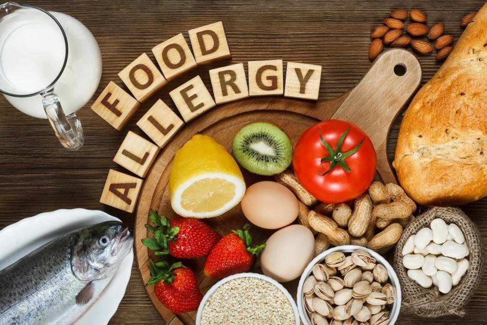 Exploring Dietary Restrictions and Allergies