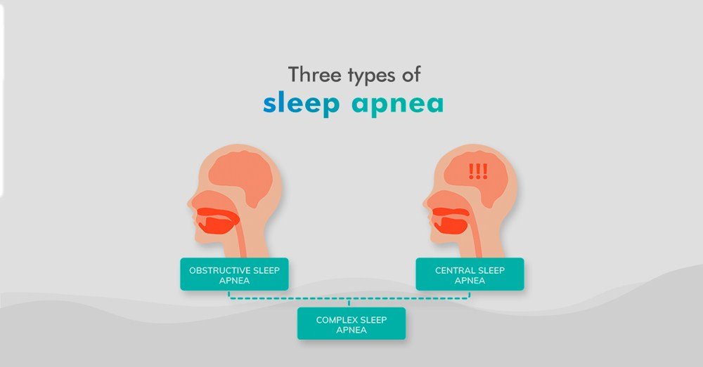 Common Causes & Symptoms Of Sleep Apnea