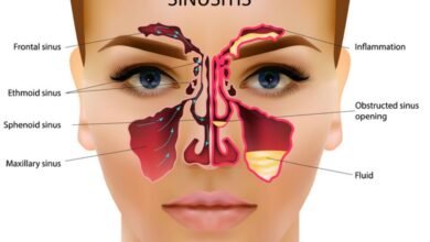 7 Things You Can't say About the Care of Your Sinuses