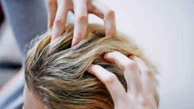 Advance Hair Clinics: Do They Work?