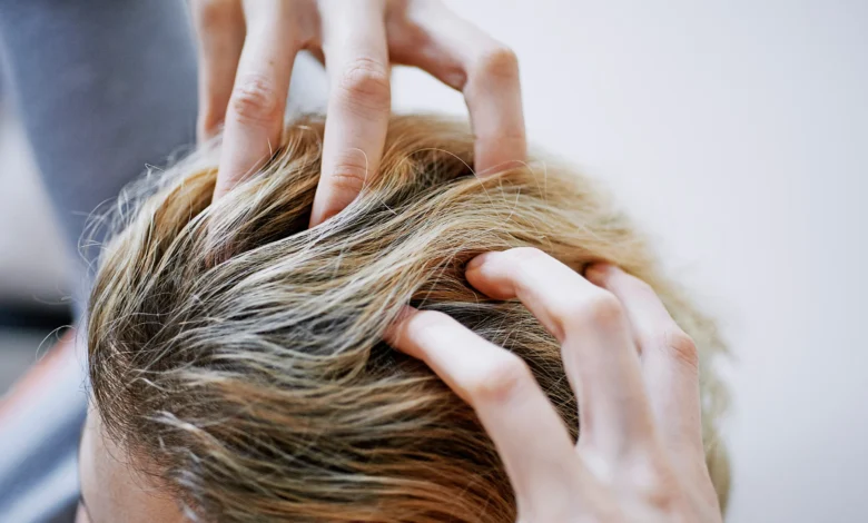 Advance Hair Clinics: Do They Work?