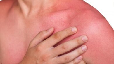 10 Reasons For Itchy Red Patches On The Skin