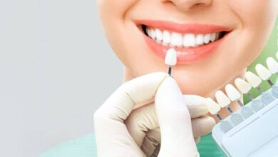 Who Makes a Good Candidate for Teeth Whitening?