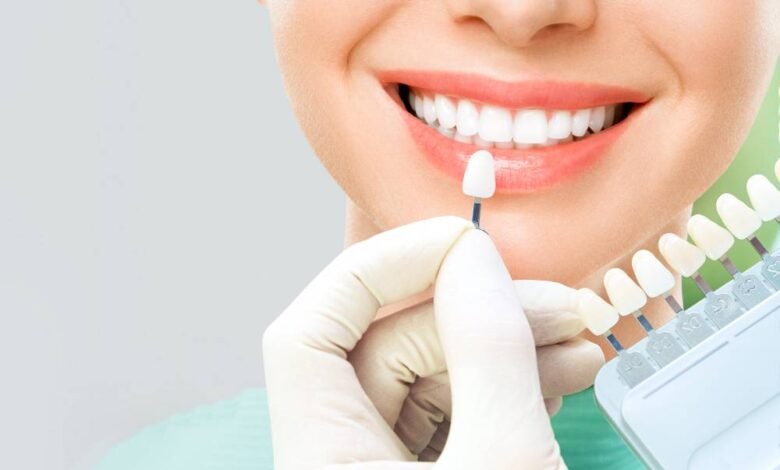 Who Makes a Good Candidate for Teeth Whitening?