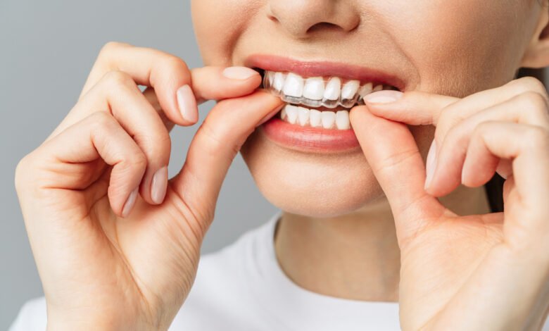 Adults and Children's Teeth Straightening with Braces