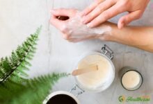 9 Best Natural Remedies for Eczema