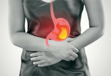 Acidic Foods Digestive Health