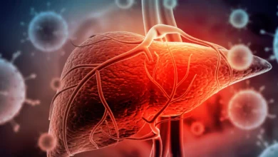 Hepatitis: Causes, Symptoms & Treatments in 2023