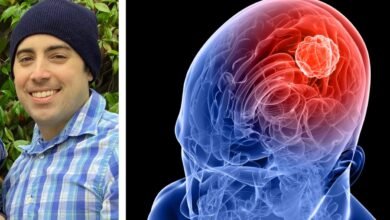 7 Warning Signs You Should Never Ignore: Could It Be a Brain Tumor?