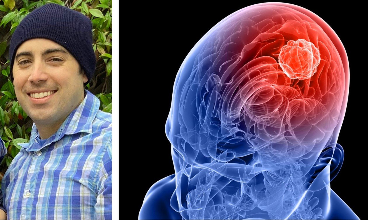 7 Warning Signs You Should Never Ignore: Could It Be a Brain Tumor?