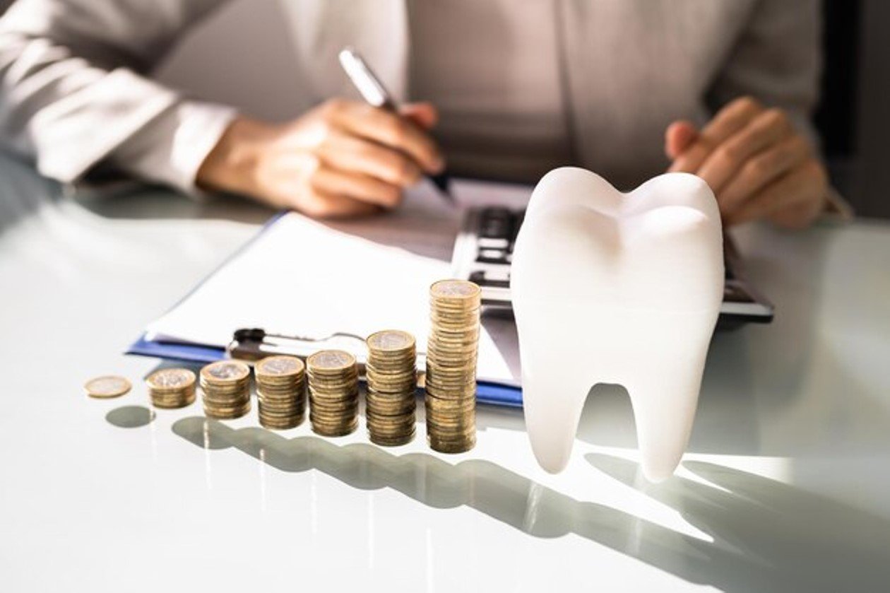 Cost of Dental Implants